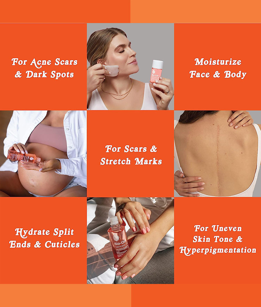 Elegant Smockers LK | Bio-Oil - Skincare Oil | Sri Lanka